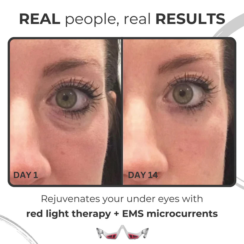 Prado Labs THERAPY LED UNDER-EYE TONER