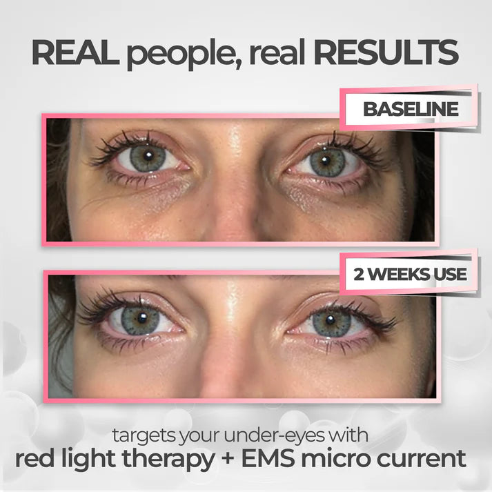 Prado Labs THERAPY LED UNDER-EYE TONER