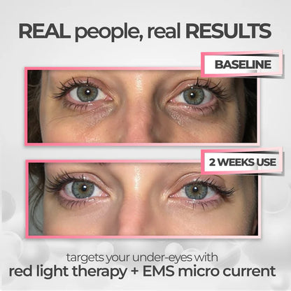 Prado Labs THERAPY LED UNDER-EYE TONER